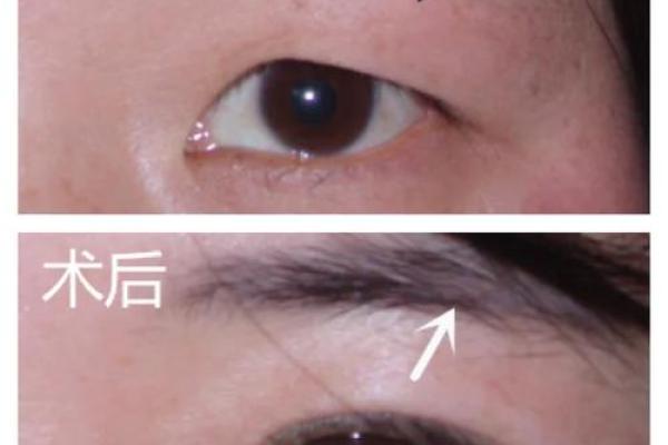 整容的八字