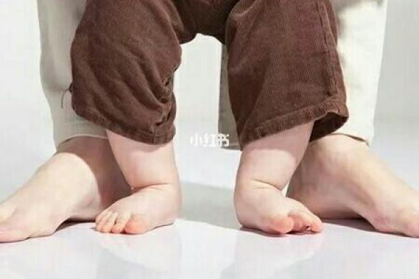 遇到宝宝罗圈腿、“八字脚”怎么办？宝妈莫着急，小编教给你