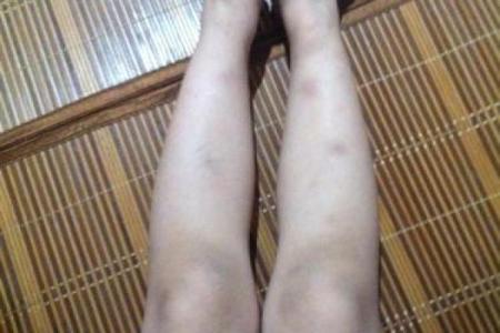 遇到宝宝罗圈腿、“八字脚”怎么办？宝妈莫着急，小编教给你