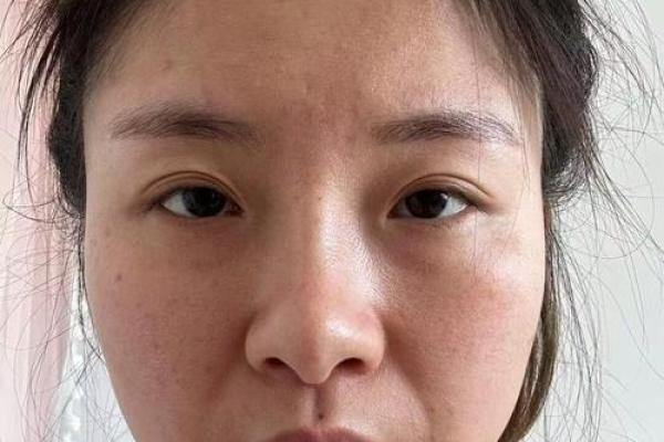 鼻子两侧八字纹图片