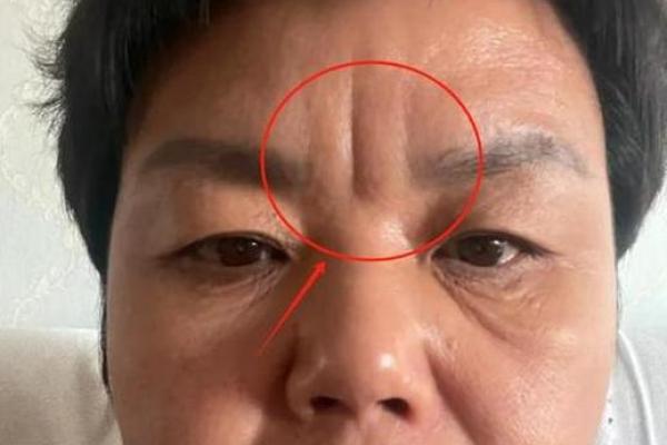 印堂八字纹的男人财运好吗