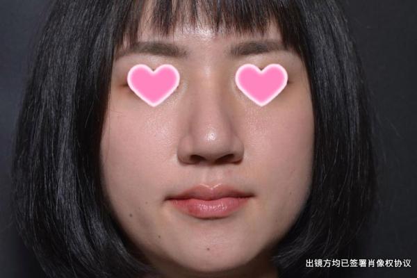 面相风水鹰钩鼻女人的好处和缺点