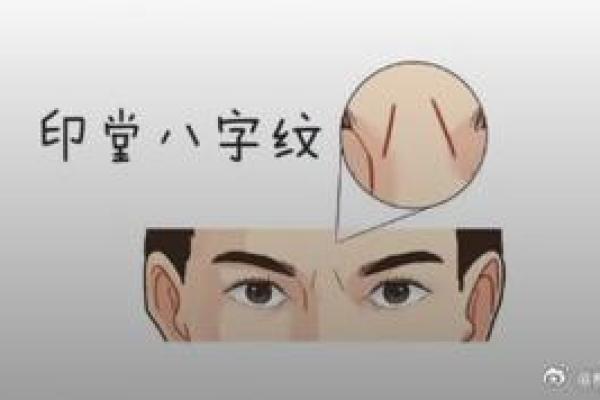额头八字纹