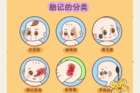 胎记如何算命-