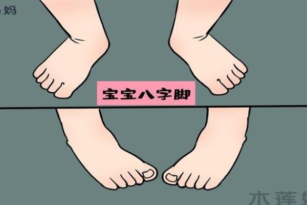 婴儿八字腿