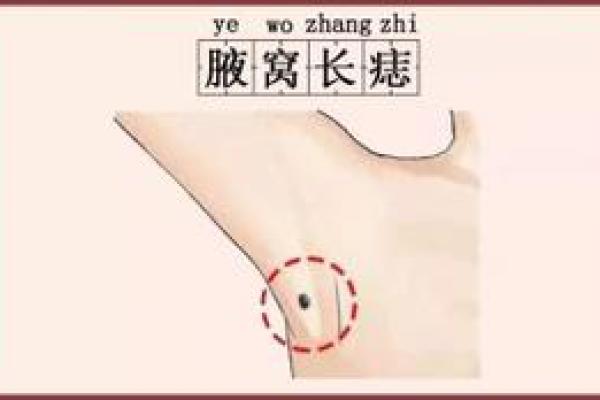 胳膊胎记算命