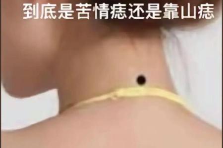 风水上后脑勺长痣代表什么意思