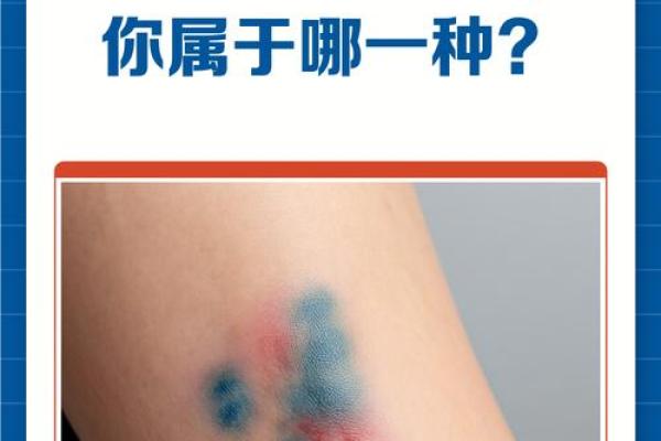 看胎记颜色类型算命